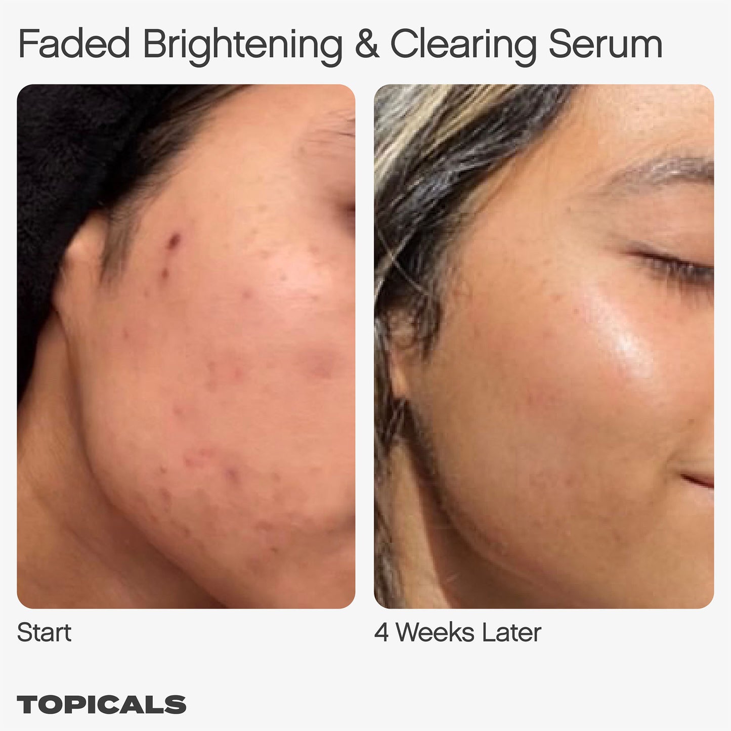 Faded Serum for Dark Spots & Discoloration - Topicals