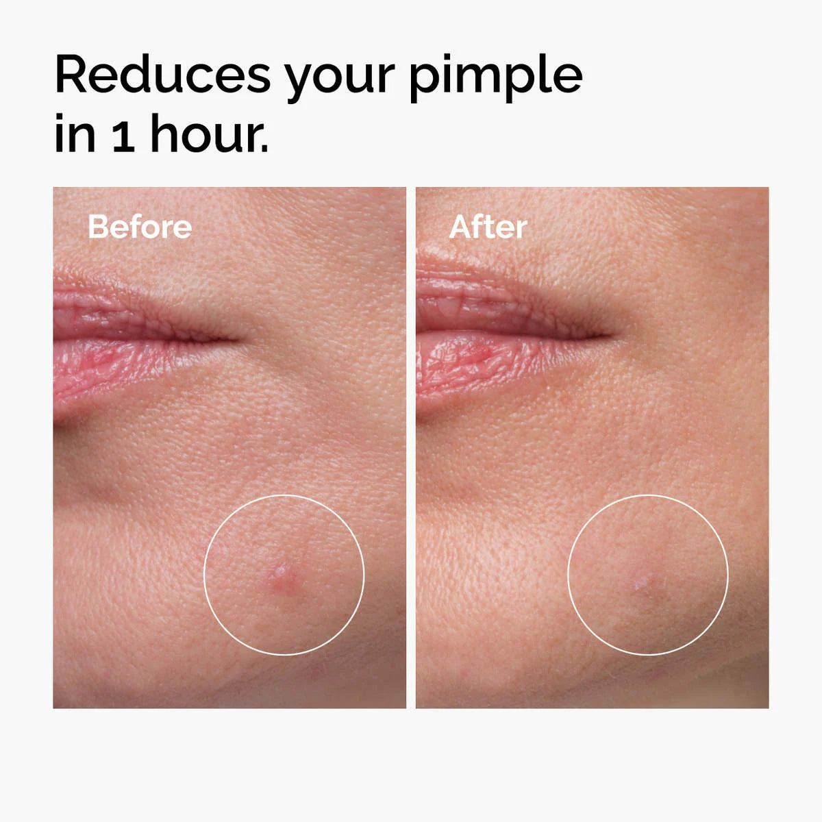 Sulfur 10% Powder-to-Cream Concentrate - The Ordinary