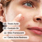 Sulfur 10% Powder-to-Cream Concentrate - The Ordinary