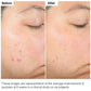 Salicylic Acid 2% Solution - The Ordinary